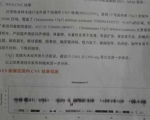 重庆代生怎么联系,，解说一下北京继发性不孕试管成功率_临沂供卵公司-生精片