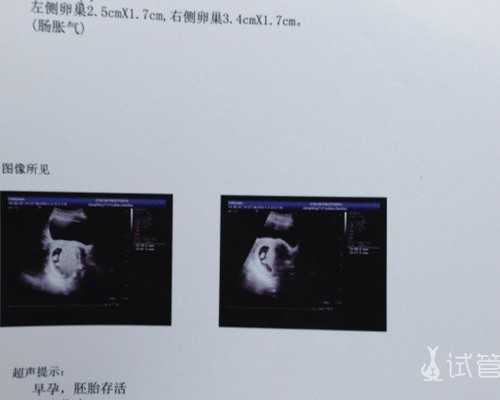 重庆做试管代孕需要住院吗|【解读】兰州供卵试管大概多少钱