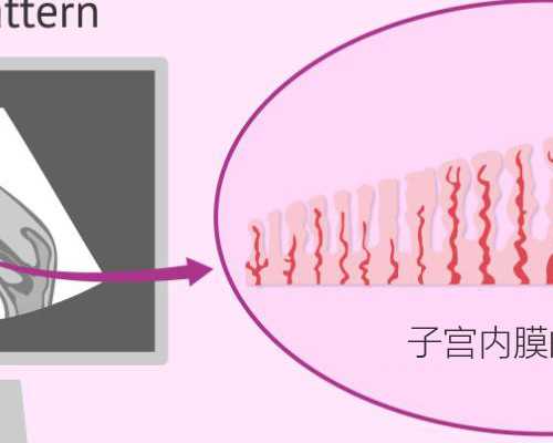 <strong>怀孕能不能吃豆浆鸡蛋~~咨询试管代生</strong>