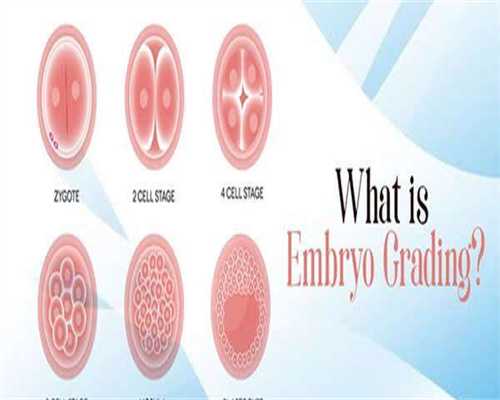 睾丸彩超不育