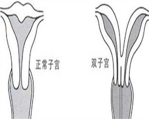 性欲低下不育