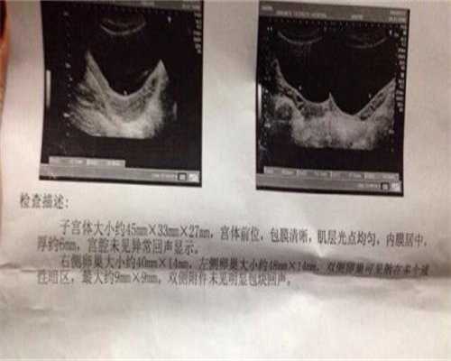 纵隔子宫不孕