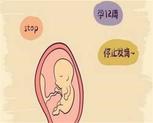 男科不育